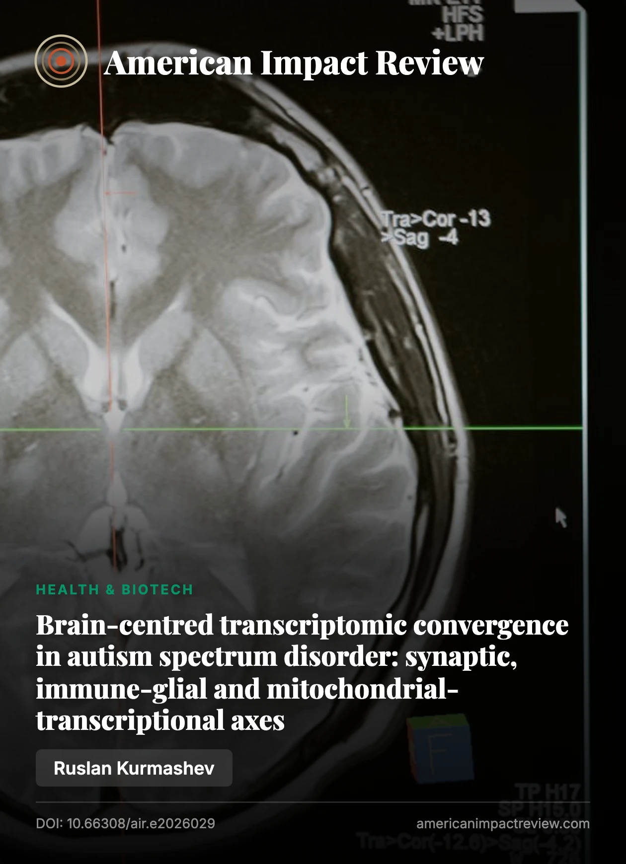 Cover: Brain-centred transcriptomic convergence in autism spectrum disorder: synaptic, immune-glial and mitochondrial-transcriptional axes.