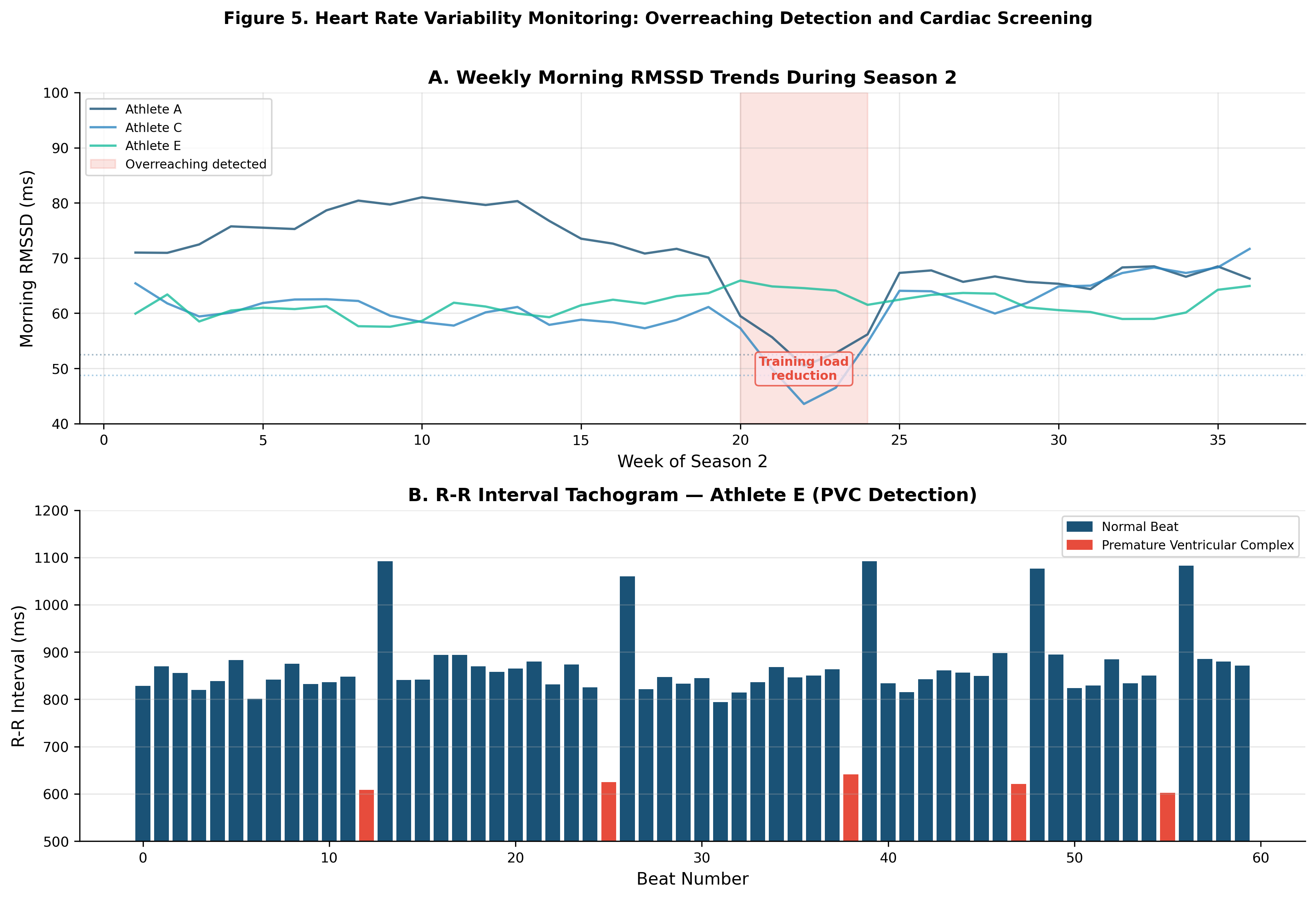 Figure 5. Heart rate variability monitoring applications. (A) Weekly morning RMSSD trends showing overreaching detection in Athletes A and C during Season 2; (B) R-R interval tachogram from Athlete E showing normal sinus arrhythmia pattern consistent with high vagal tone.